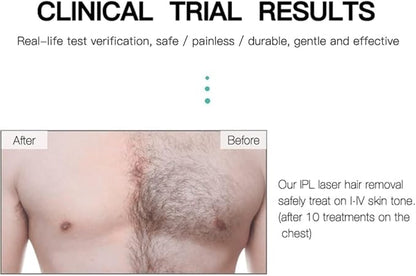 LUMI IPL Permanent Hair Removal Device